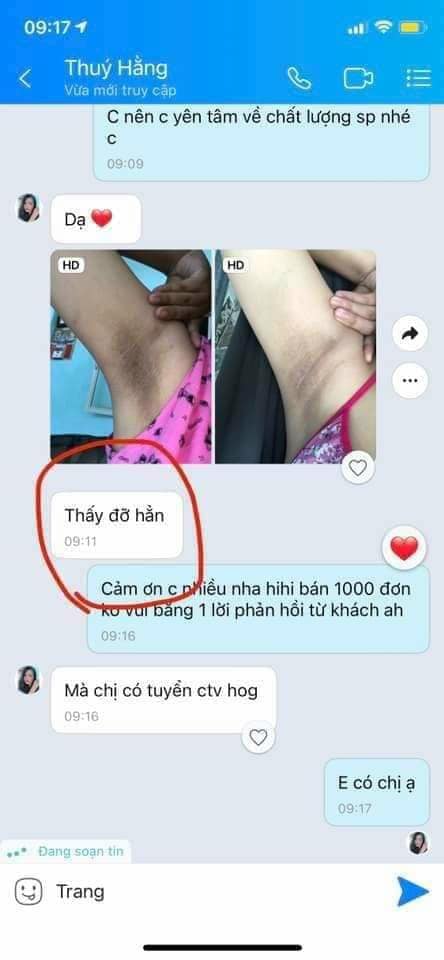 Kem Qnic Khử Thâm Nách và Bikini Thái Lan