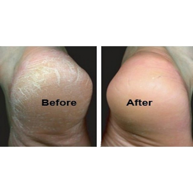 Kem dầu ngựa Nứt gót chân 30ml ( Hàng nội địa )