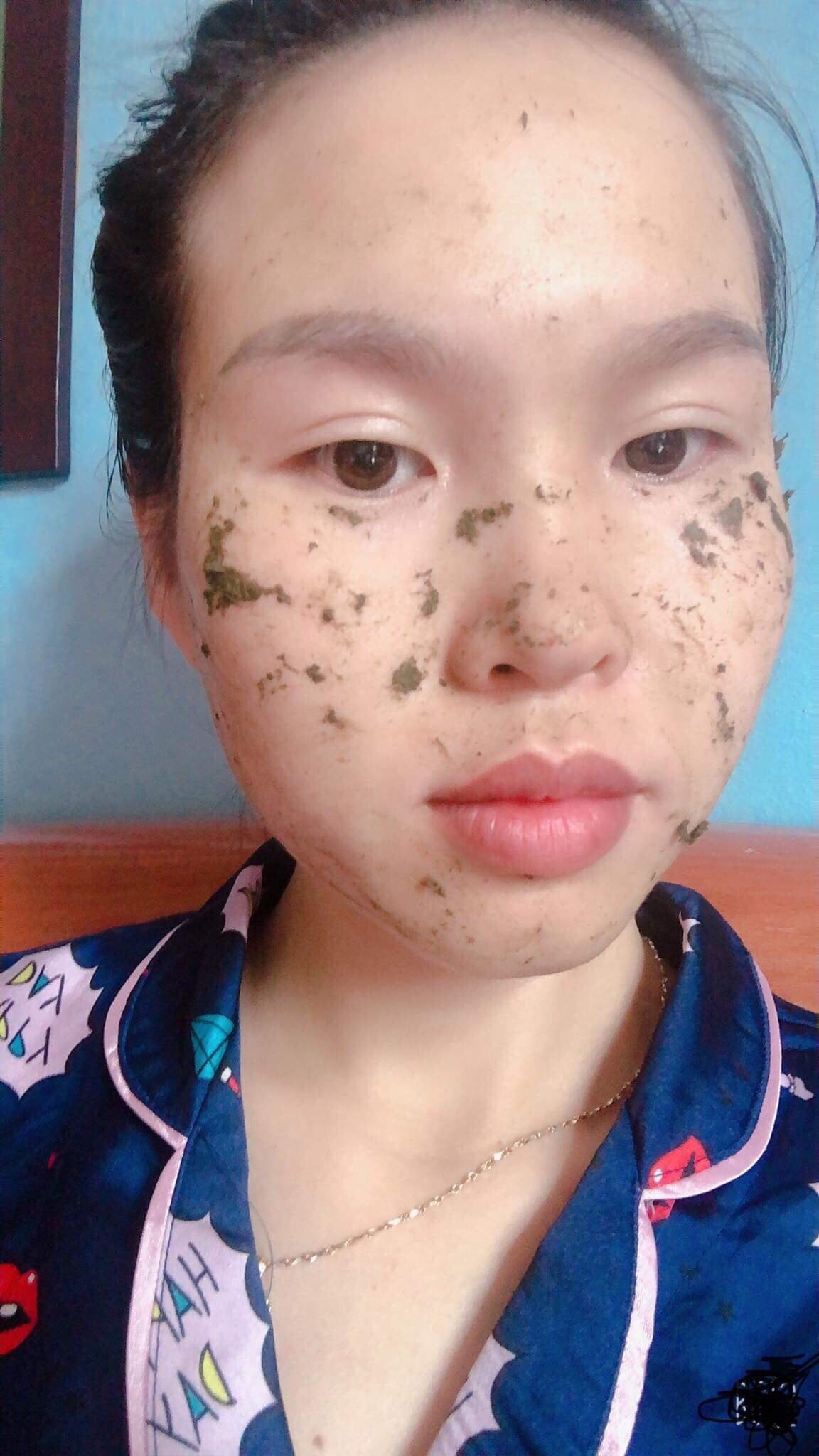 Cỏ trị nám, tàn nhang Lý Gia .