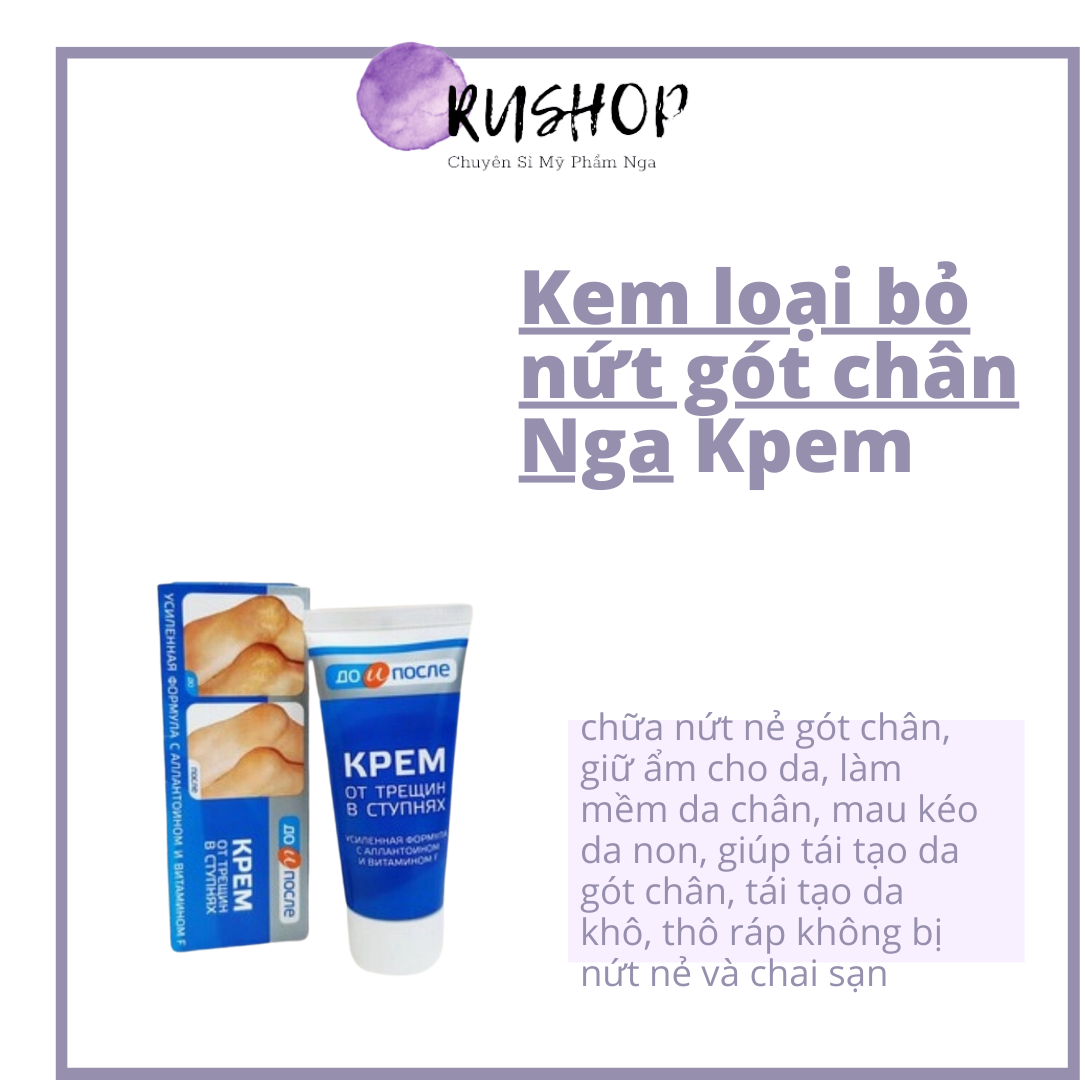 Kem loại bỏ nứt gót chân Nga làm mềm gót chân