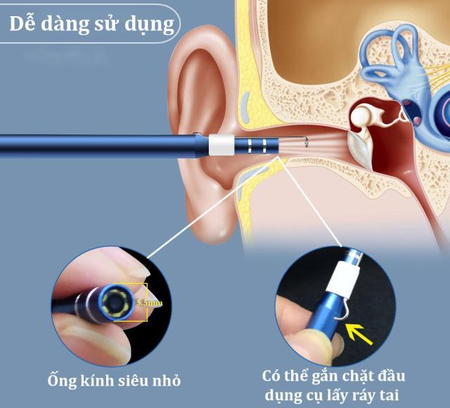 [BẢO HÀNH UY TÍN]Camera nội soi y tế, Camera nội soi tai, mũi, họng -dụng cụ lấy ráy tai,bút camear nội soi- Máy lấy ráy tai HD Visual Earwas Clean Tool cho hình ảnh sắc nét, sử dụng dễ dàng trên điện thoại và máy tính