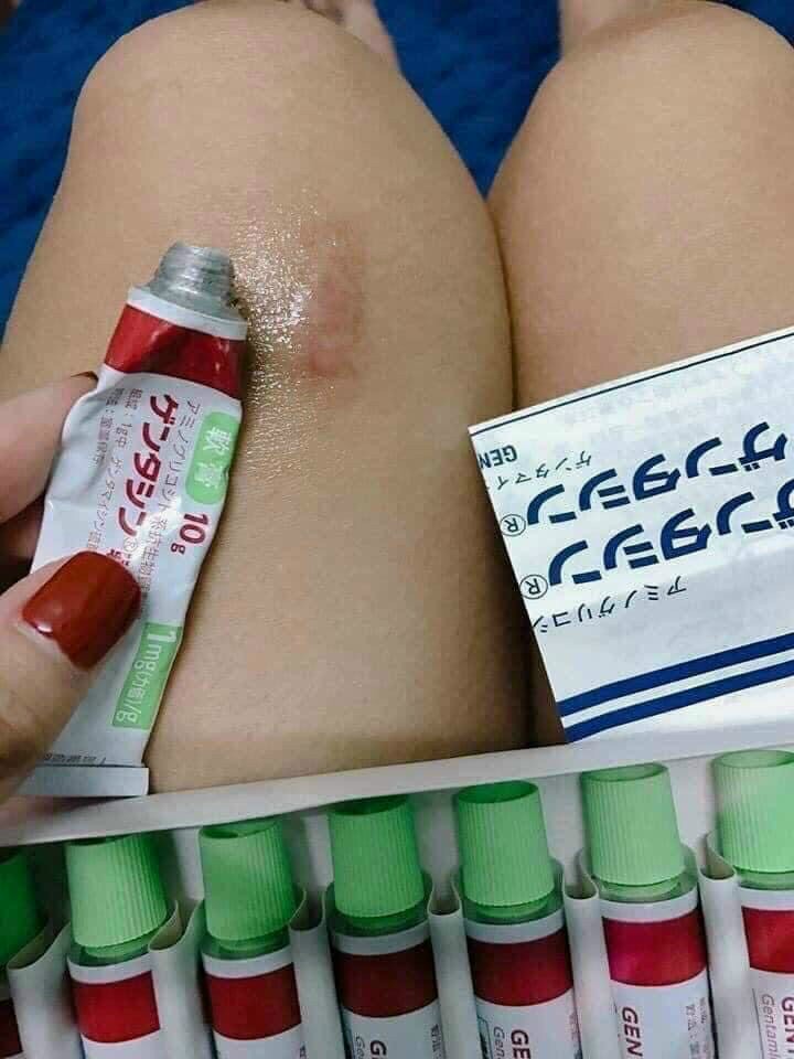 [HCM]KEM MỜ SẸO GENTACIN - Tuýp 10g