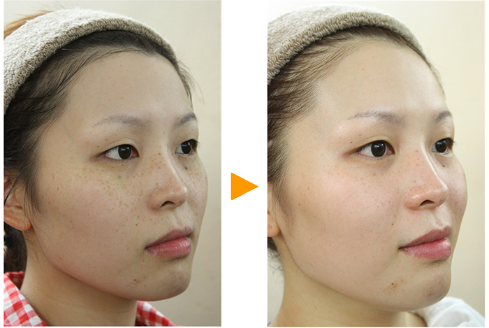 Kem mờ nám Eucerin giảm thâm nám làm sáng da hiệu quả