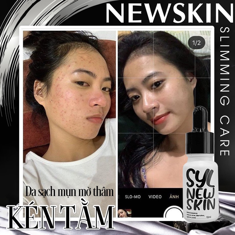 Newskin