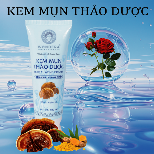 [HCM]Kem Mụn Thảo Dược Wondera Cao Cấp 100g không để lại sẹo thâm