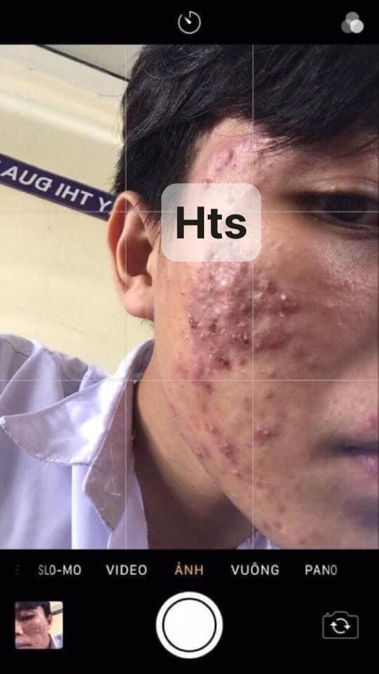 BỌT RỬA MẶT THẢO DƯỢC HOÀNG THIÊN SÂM