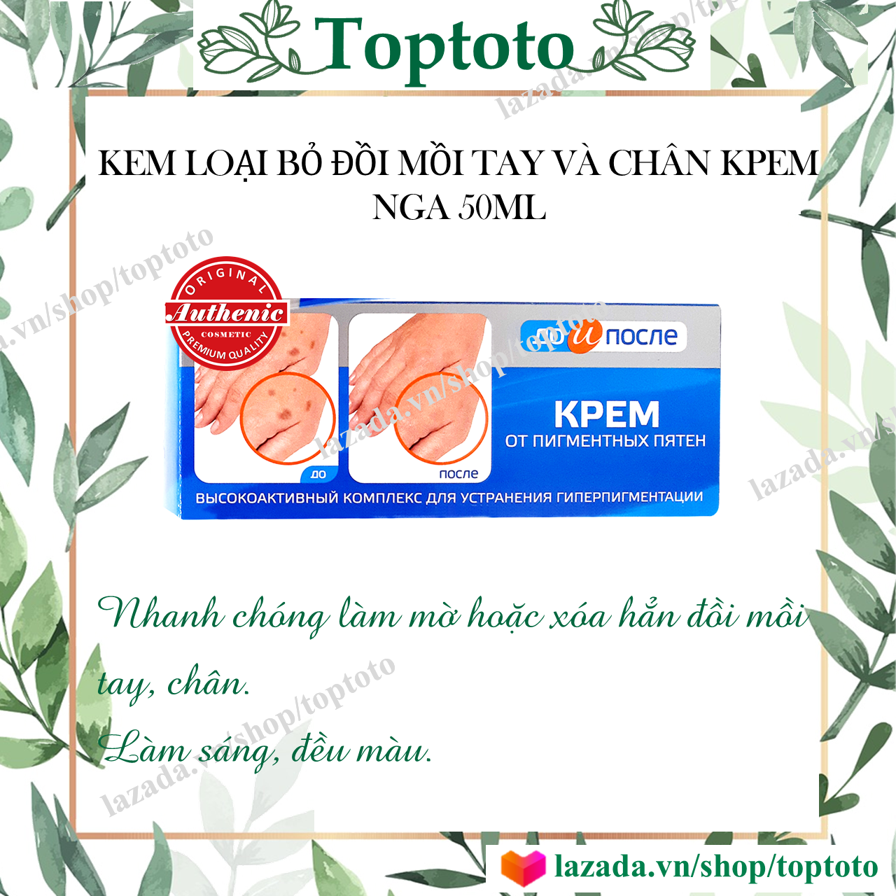 [HCM]Kem đồi mồi tay chân kpem