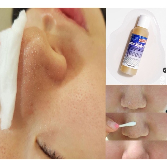 Dung Dịch Ủ Mụn Đầu Đen Medi Peel Extra Super 9 Plus 1000ml