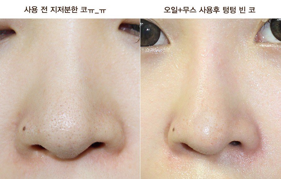 Mặt nạ 3 bước lột mụn đầu đen Innisfree Jeju Blackhead 3 Step Program