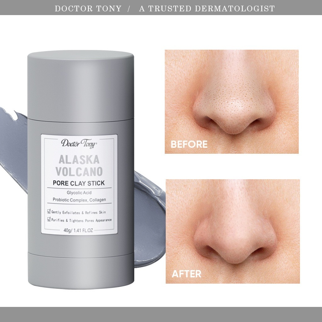 Thanh lăn mặt nạ đất sét tro núi lửa Alaska lột mụn đầu đen làm sạch sâu 40g