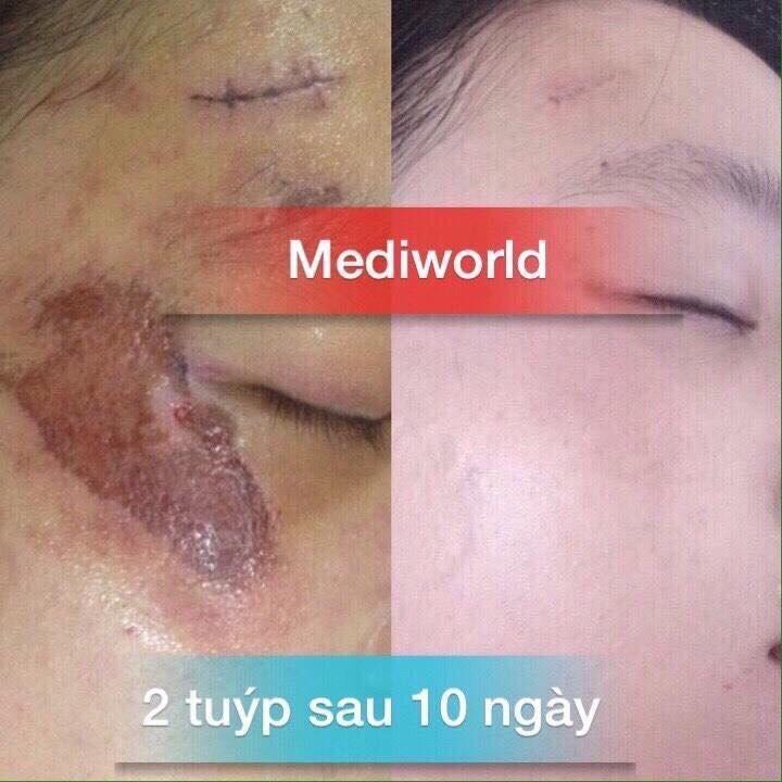 [HCM]Medigen – Dịch chiết Tế bào gốc trẻ hoá da