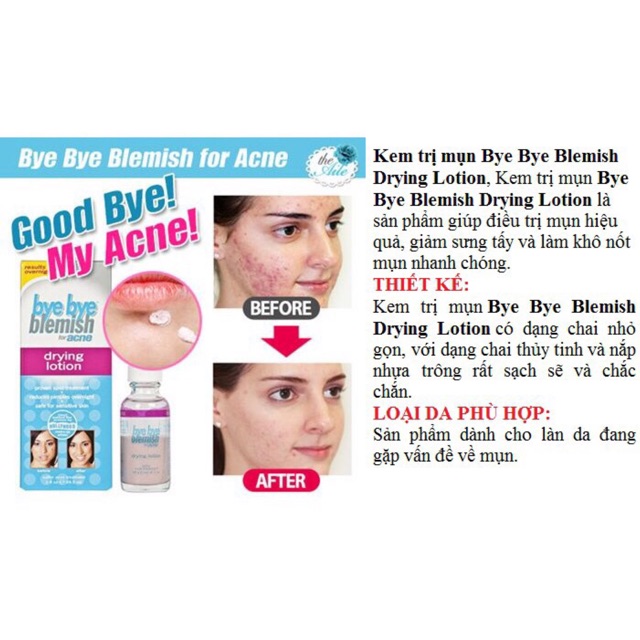Lotion Chấm Mụn Lưu Huỳnh Ngăn Mụn Cấp Tốc Byebye Blemish Drying (Bye Bye Blemish Drying Dung Dịch Chấm Mụn)