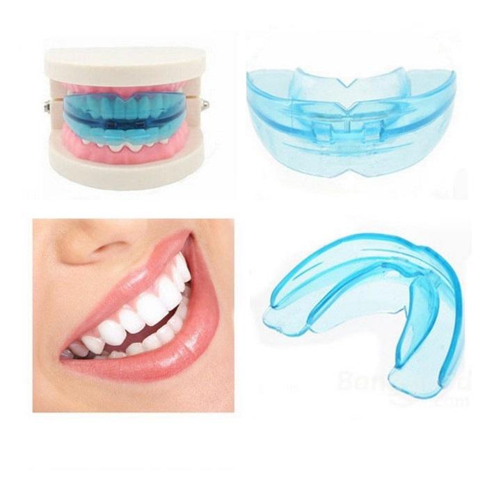 Dụng cụ niềng răng tại nhà