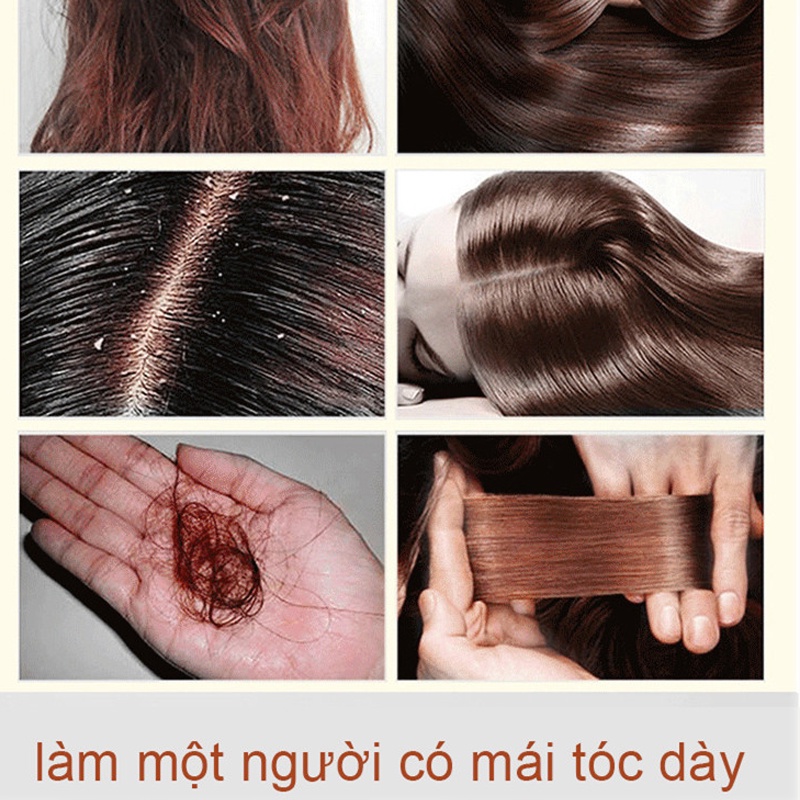 Tinh chất mọc tóc tinh dầu mọc tóc 30ml serum kích mọc tóc chăm sóc tóc chống rụng tóc,kích thích tóc mọc dà
