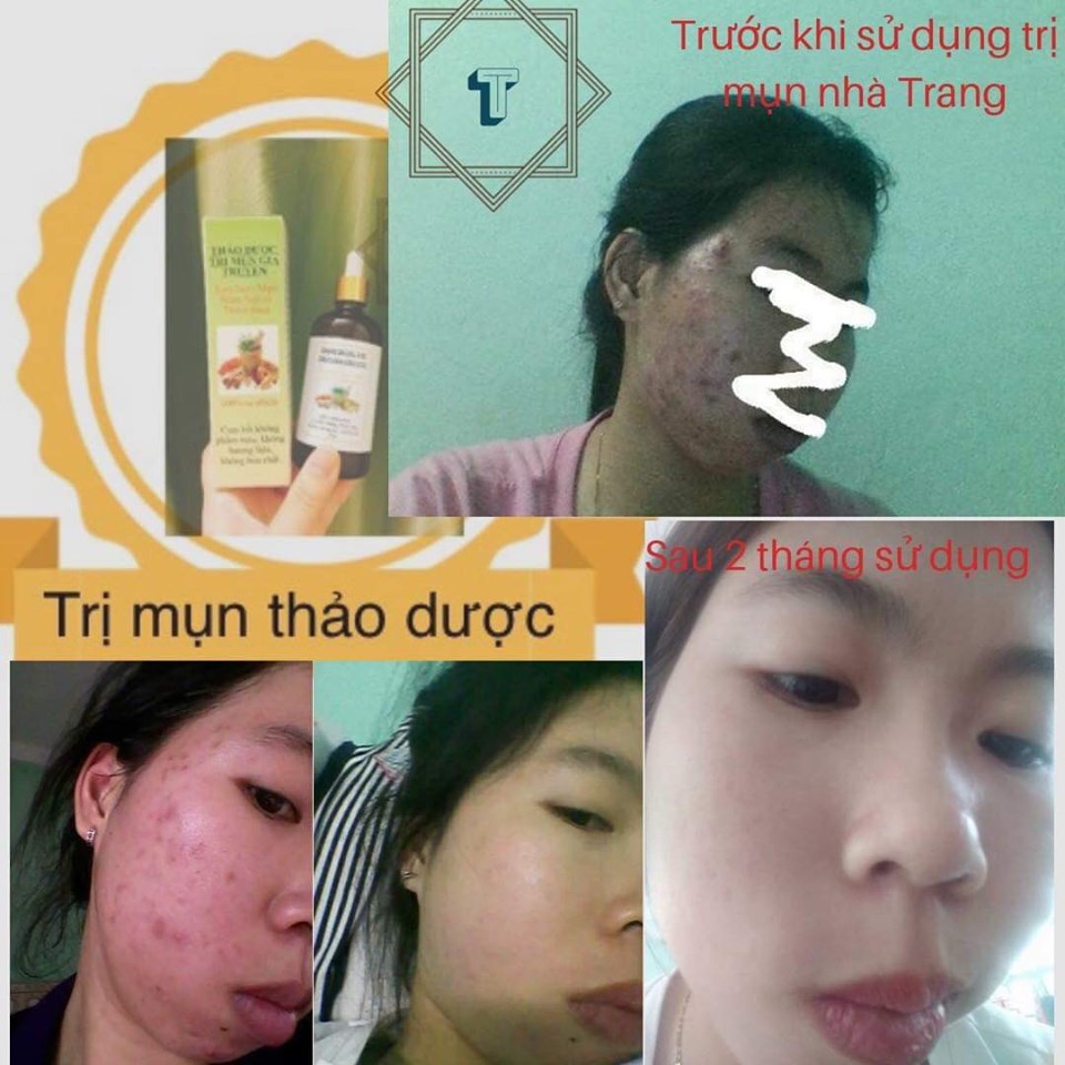 thao duoc 100ml