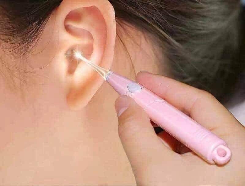 Dụng Cụ Lấy Ráy Tai Có Đèn Led