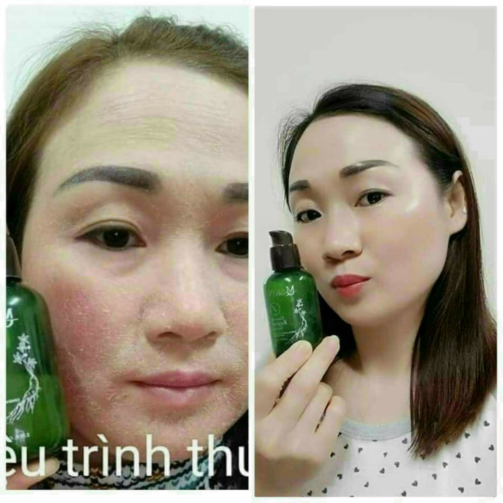 Tái tạo nhân sâm MQ skin