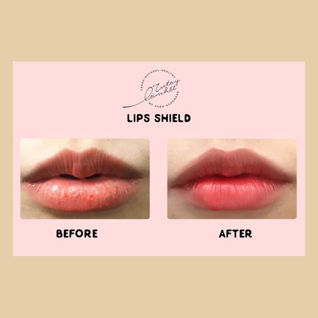 Mặt nạ môi làm hồng môi Lipsshield TTLH | TUTAYLAMHET