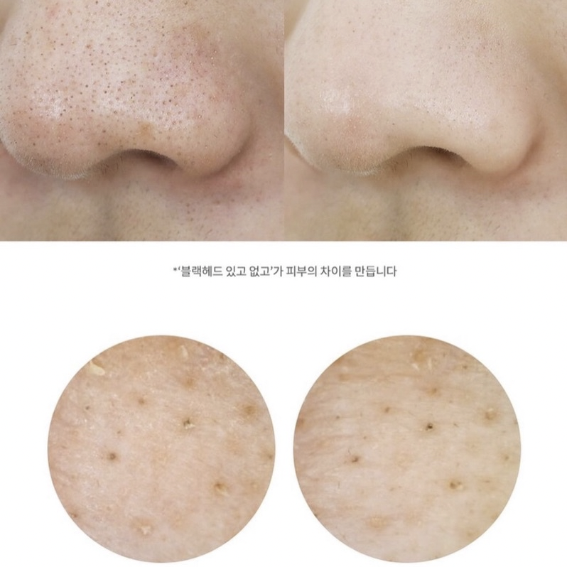 [MINISIZE] Bộ sản phẩm dưỡng da MANYO