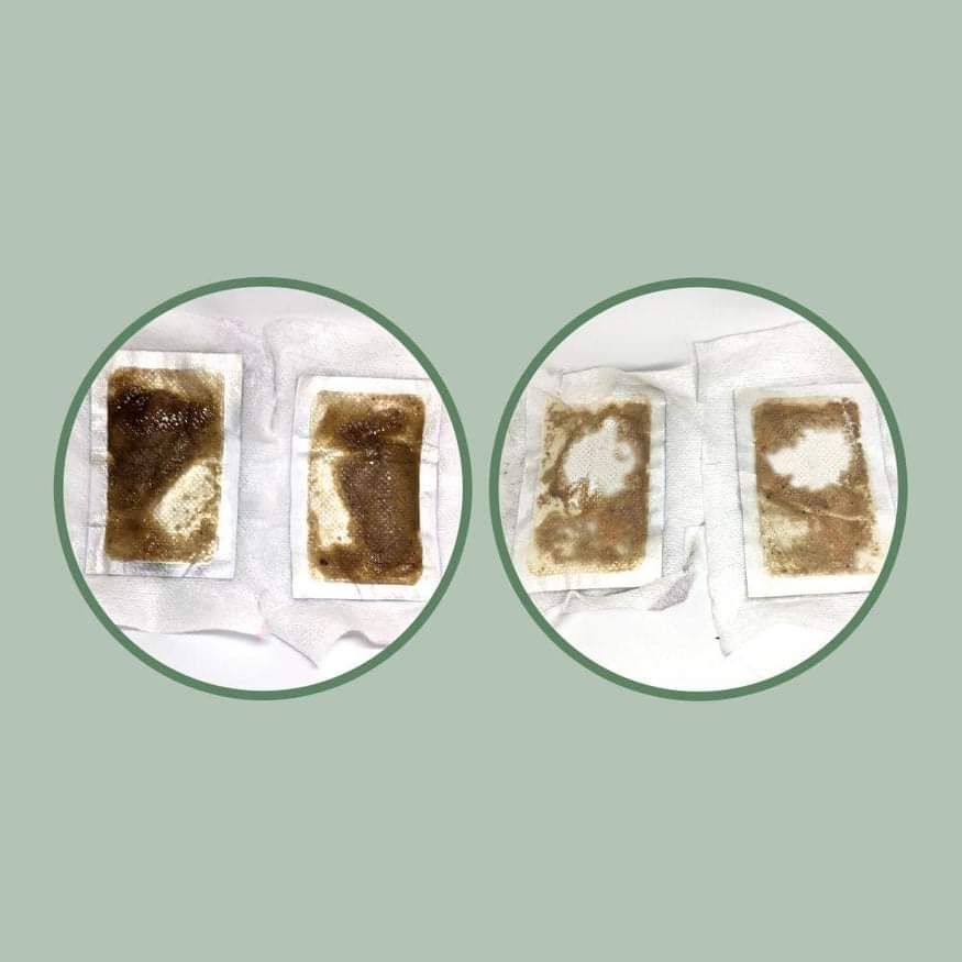 Dermax relat Miếng dán Thải Độc Giảm Cân