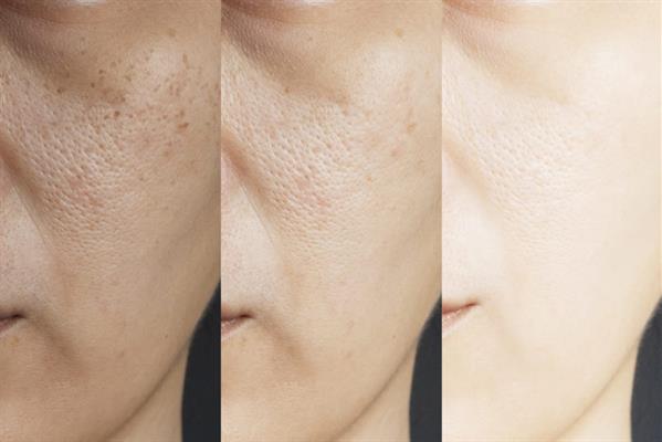 [HCM]Toner Bạc Hà Lamer Care - Dr. Lacir 100ml
