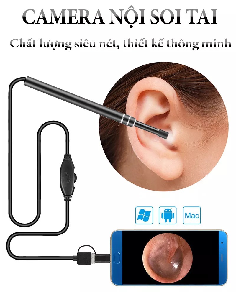 Dụng Cụ Lấy Ráy Tai Thông Minh, Camera Nội Soi Tai Siêu Nét Đi Kèm Bộ Đầu Lấy Ráy Nhỏ Gọn Tiện Dụng