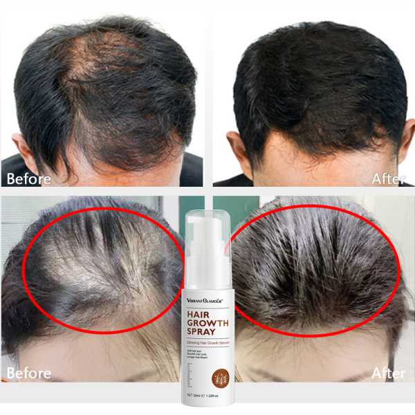 VIBRANT GLAMOUR Xịt tinh chất mọc tóc tự nhiên Chăm sóc tóc Ngăn ngừa rụng tóc Nuôi dưỡng chân tóc Hair Growth