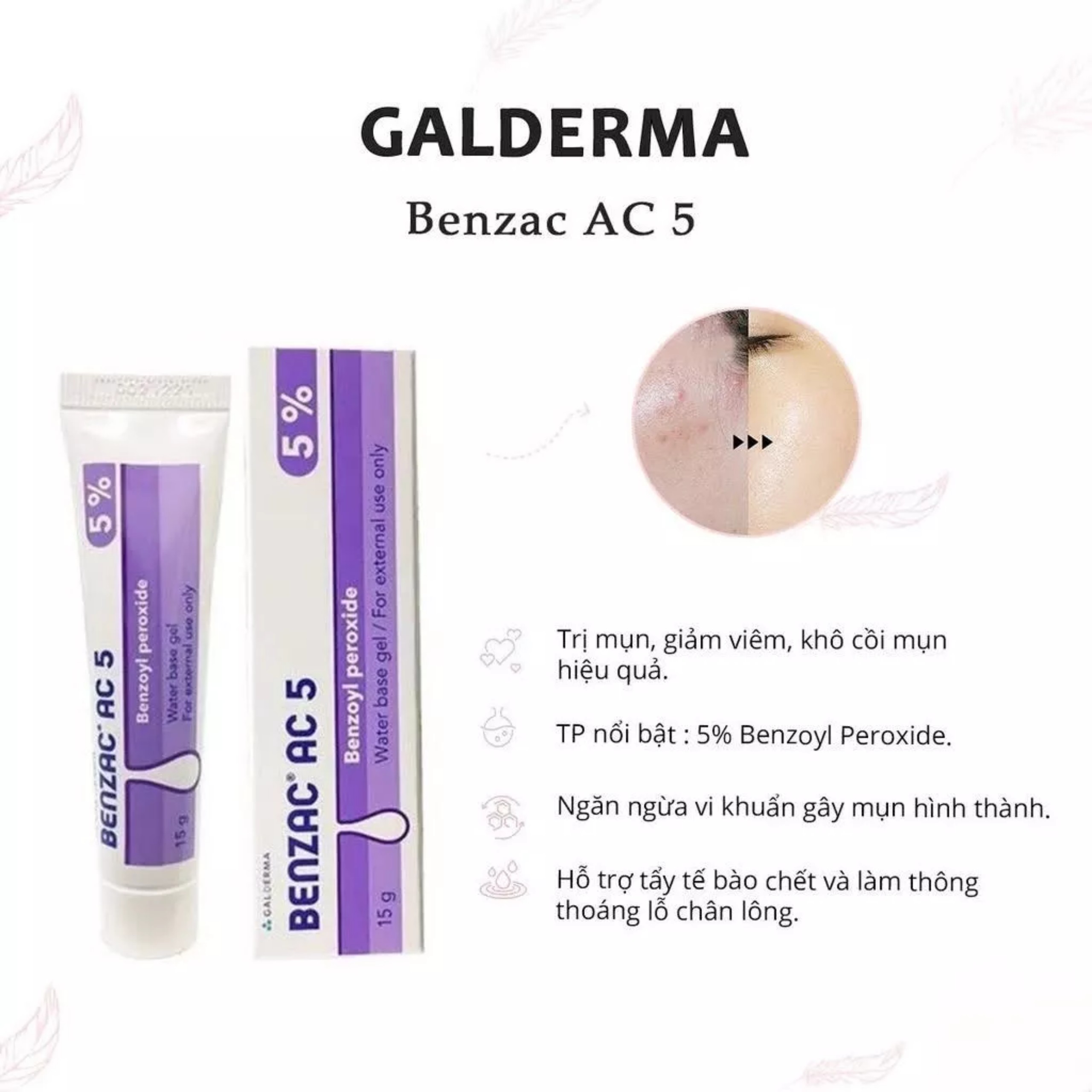 Gel chấm mụn Benzac AC 5% (Benzoyl peroxide 5%) Chính Hãng