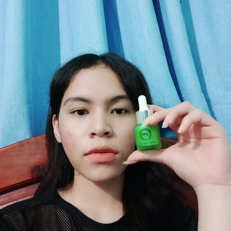 [HCM]Combo Sạch Mụn Thâm Trắng Da Venus