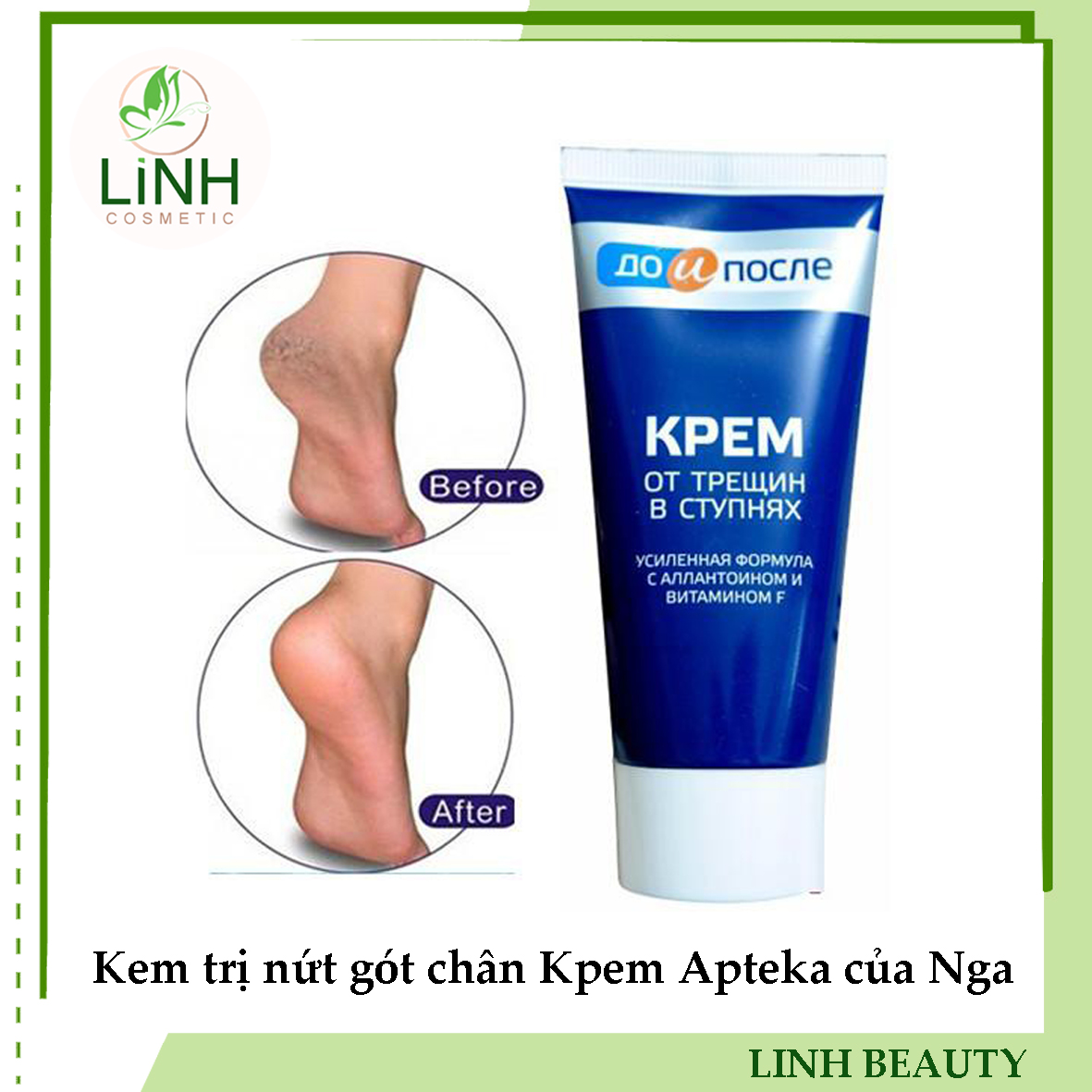Kem gót chân  Apteka của Nga