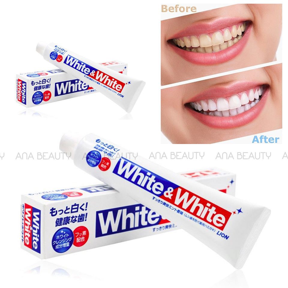[HCM]Kem Đánh Răng White & White Lion Nhật Bản