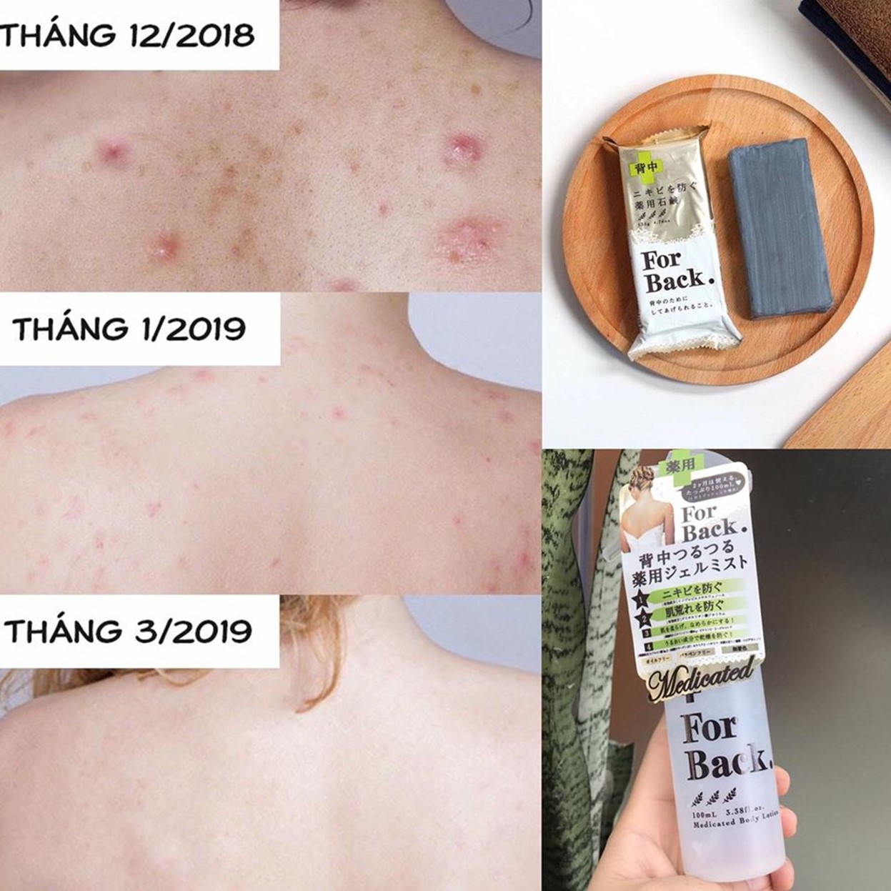 Combo 2 Sản Phẩm Giảm Mụn Lưng Pelican For Back (Xà Phòng Soap 135g + Xịt Body Lotion 100ml)