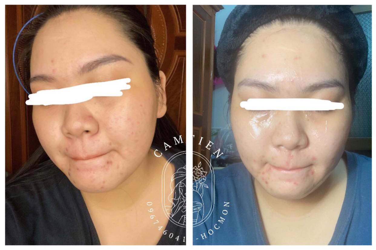 MASK YẾN TƯƠI COLLAGEN SỢI TẢO