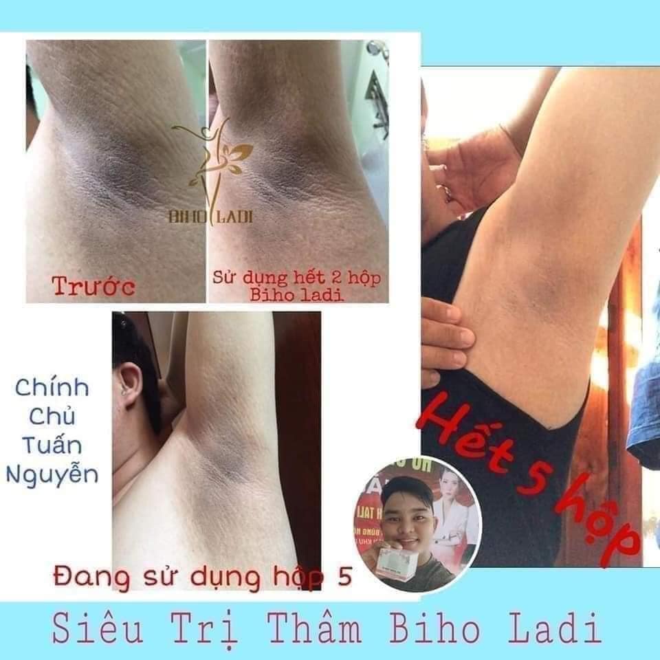 [HCM]5S BIHOLADI 5S - Siêu Dưỡng thâm chính hãng