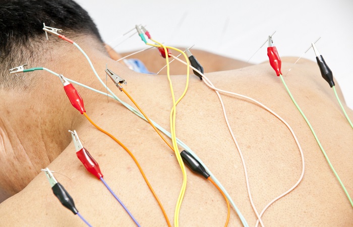 Máy châm cứu điện châm 20 kim 5 cọc tặng kèm 4 pin AA