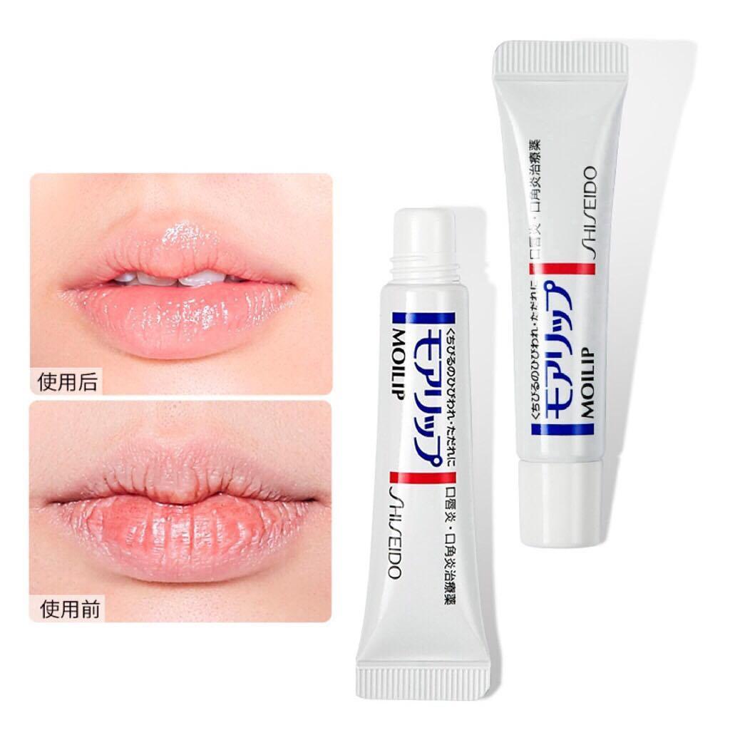 Son dưỡng tri nẻ môi Shiseido Moilip 8g - Nhật Bản