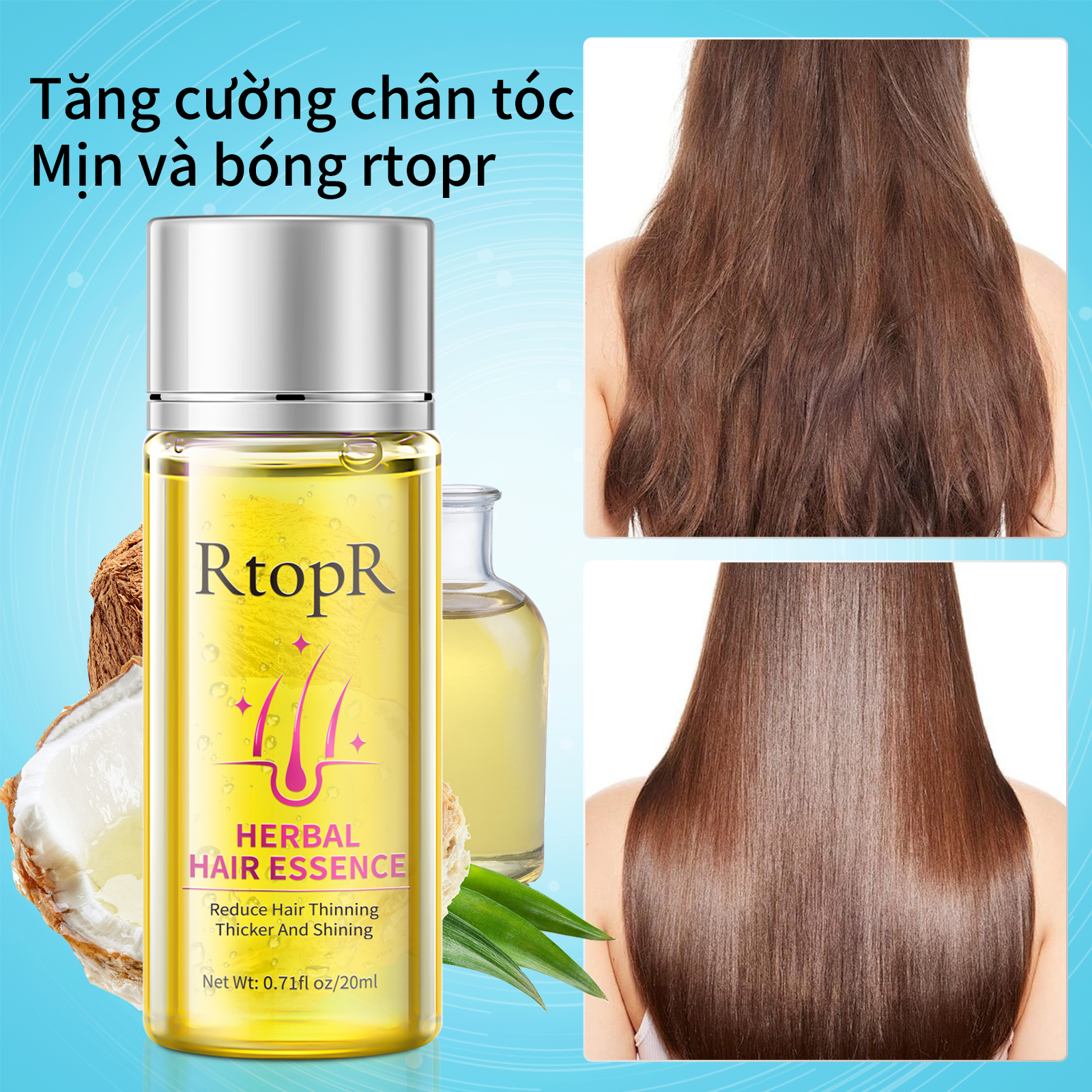 Tinh chất chống rụng tóc và kích thích mọc tóc RtopR - INTL