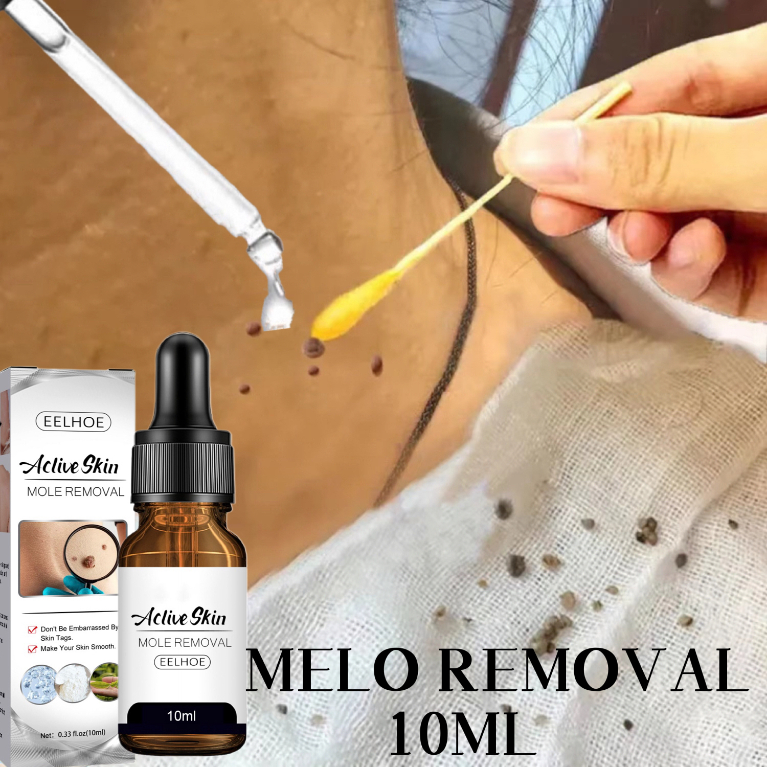 Serum tẩy nốt ruồi xóa mụn ruồi trên mặt, tàn nhang, mụn cóc, mụn thịt , mụn cơm, mắt cá tại nhà an toàn và gel mờ sẹo, Kem ngăn sẹo nga kem ngừa sẹo lồi thâm sẹo rỗ lâu năm các loại sẹo mụn 10ml