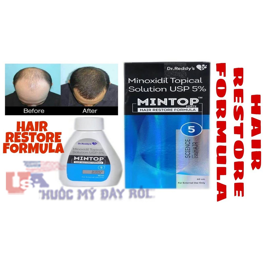 (Tặng Peo Kích Mọc) Dung Dịch Mọc Râu Minoxidil 10% MINTOP Hair Restore Formula