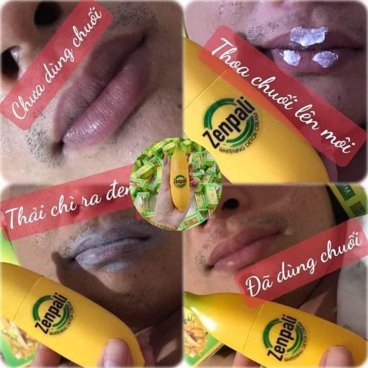 🍌🍌🍌Chuối Zenpali - Cấy trắng Detox Thải Chì Thải Độc🍌🍌🍌
