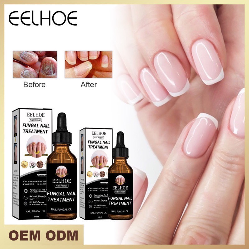 [Serum nấm móng] tinh chất thảo dược nấm móng tay chân nhập khẩu