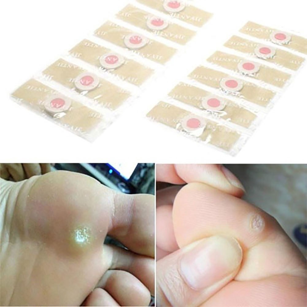 5 Miếng Dán Tẩy Mụt Cóc Nhanh Hiệu Quả Cao