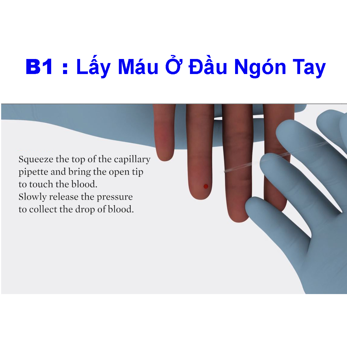 Test Nhanh HIV 1/2 ABBOTT BIOLINE Hàn Quốc