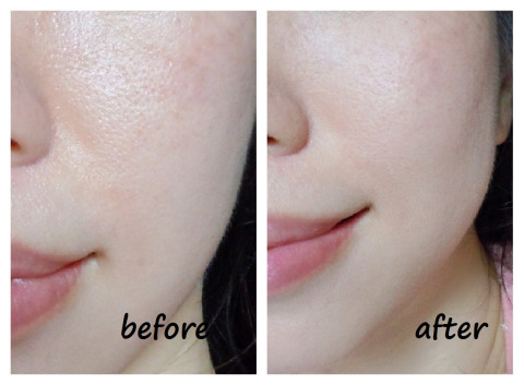 Phấn phủ kiềm dầu - phấn rôm Shiseido Baby Powder