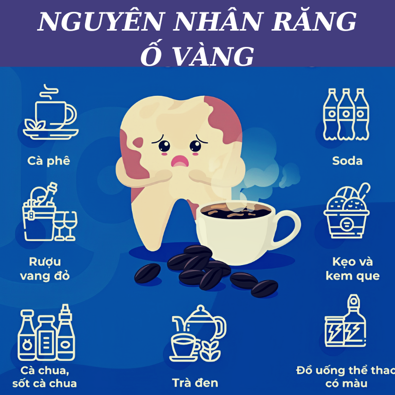 (1 GÓI 7 MIẾNG ) Miếng dán trắng răng chỉ sau 30 phút dán 5D TEETH WHITENING STIKER