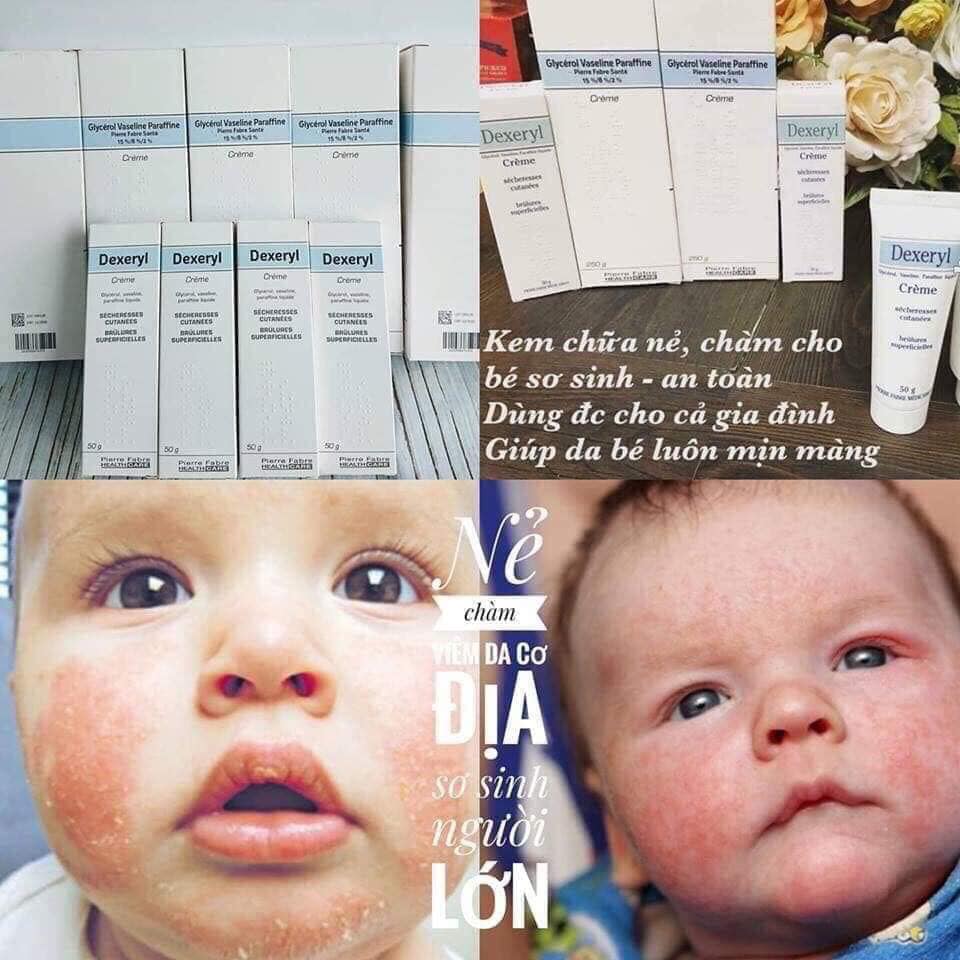 Kem Dưỡng Da Trị Nẻ Chàm Dexeryl