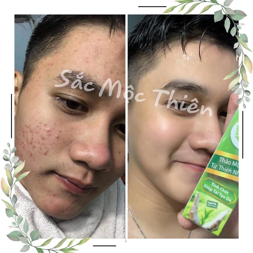 [HCM]Linh Chi Bột