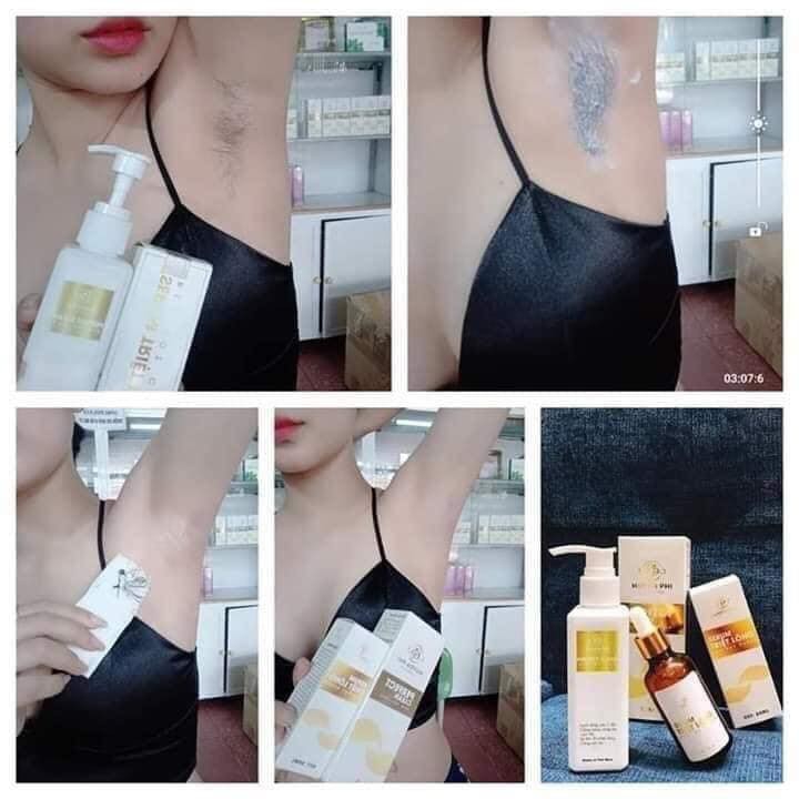 [HCM]Kem tẩy lông Huyền Phi (tặng kèm serum triệt lông)