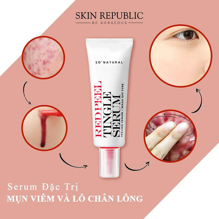 [HCM](MẪU MỚI 2020) Thay da sinh học Red Peel Tingle Serum RedPeel 20ml 35ml