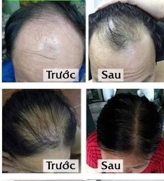 Dầu gội Thanh Mộc Hương mẫu mới 100%